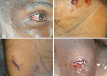 Conflit foncier autour de Gnara Beli : la tension monte entre Yimaya Dabbo et Farenya, plusieurs arrestations signalées